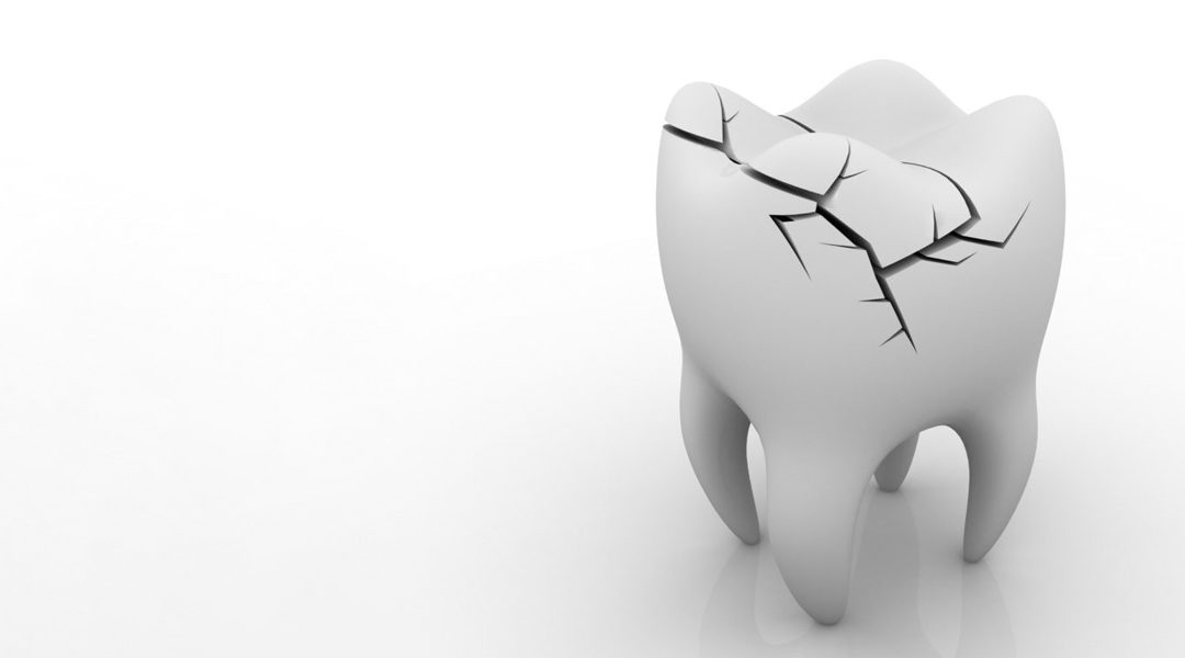 Damaged tooth? OUCH! First Aid Tips you need to know.