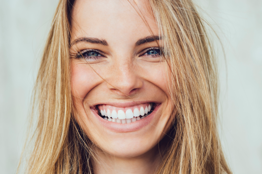 A picture of a woman showing a healthy, white teeth